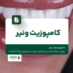 کامپوزیت ونیر