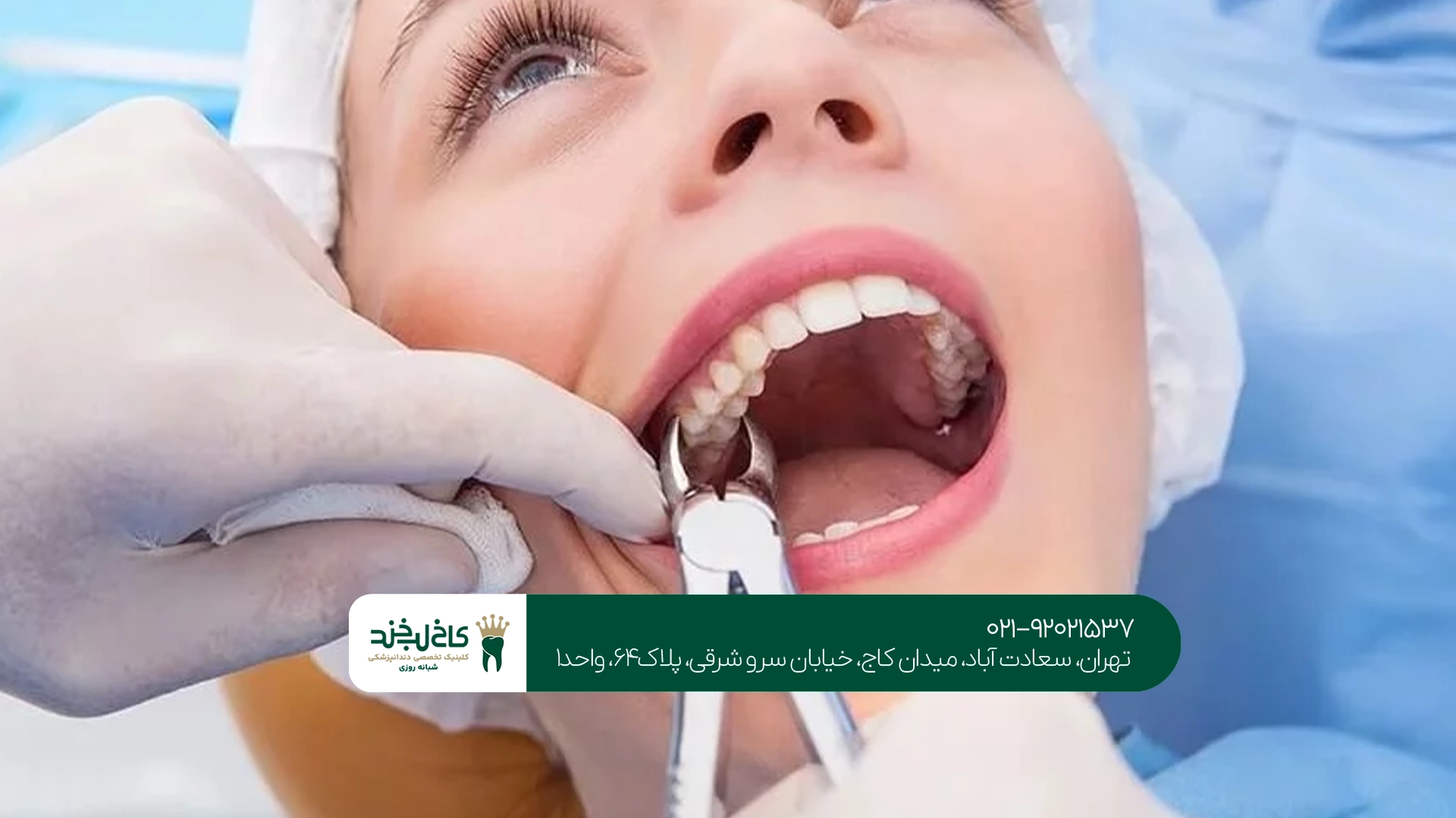 کشیدن دندان چقدر طول میکشد؟