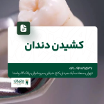 کشیدن دندان
