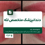 دندانپزشک متخصص لثه