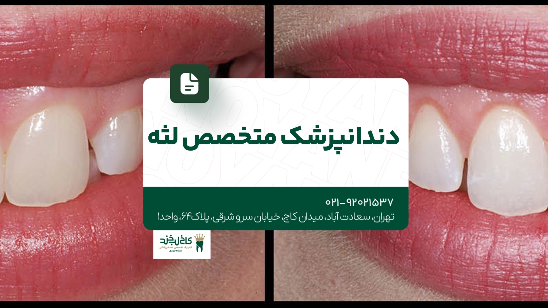 دندانپزشک متخصص لثه