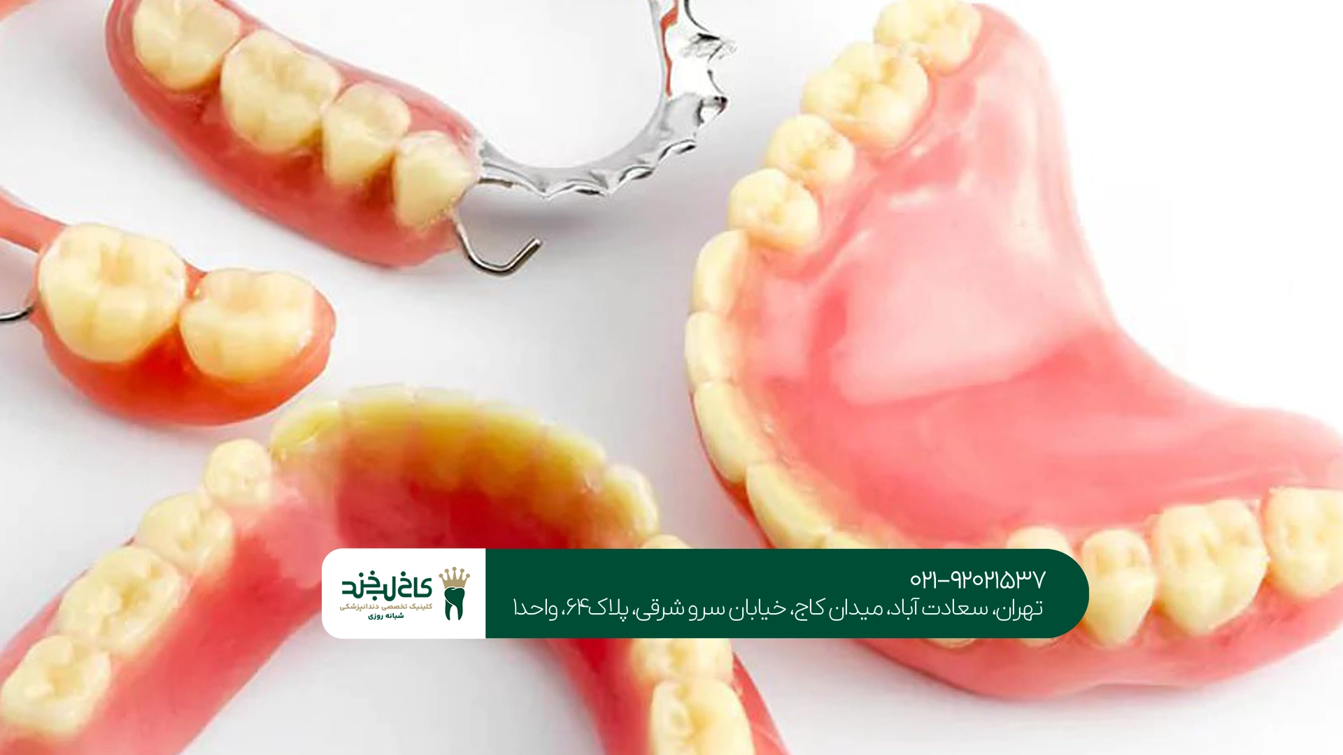 قیمت دندان مصنوعی تکی و چندتایی