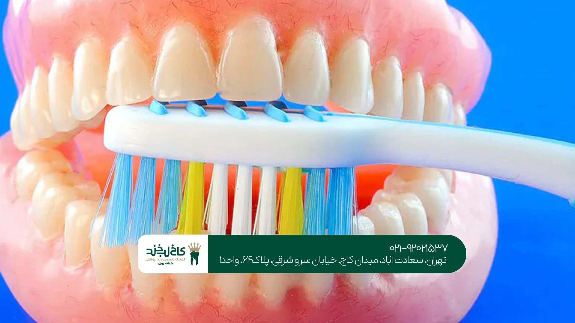 آیا قیمت دندان مصنوعی با بیمه کمتر میشود؟