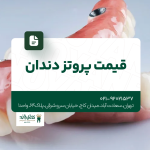 قیمت پروتز دندان